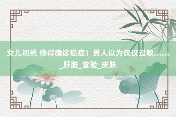 女儿初熟 倏得确诊癌症！男人以为仅仅过敏......_肝脏_查验_皮肤